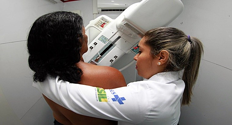 rastreamento cancer de mama 2
